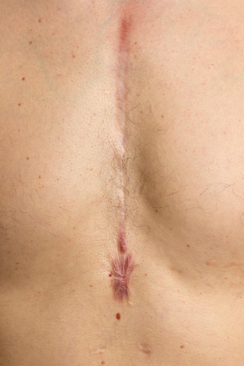 Kaip atpažinti ir reaguoti į širdies priepuolio simptomus pirmąsias 5 minutes